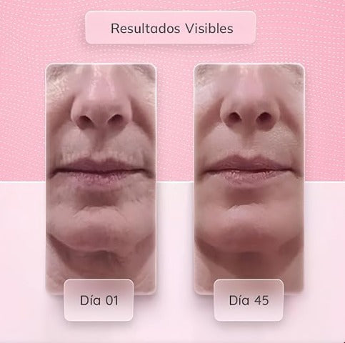 Masajeador de estiramiento Facial  (Envío Gratis)